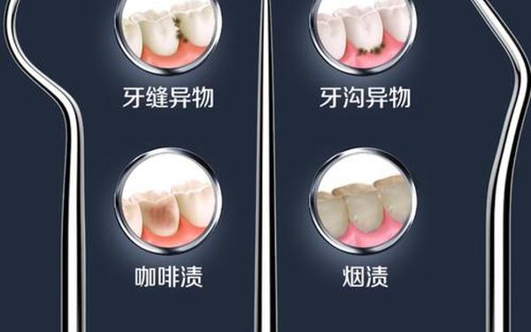 下面塞多少牙签_牙签塞牙缝里怎么取出