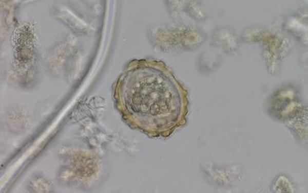仙女肚子里满满的虫卵、肚子里有虫卵会怎么样